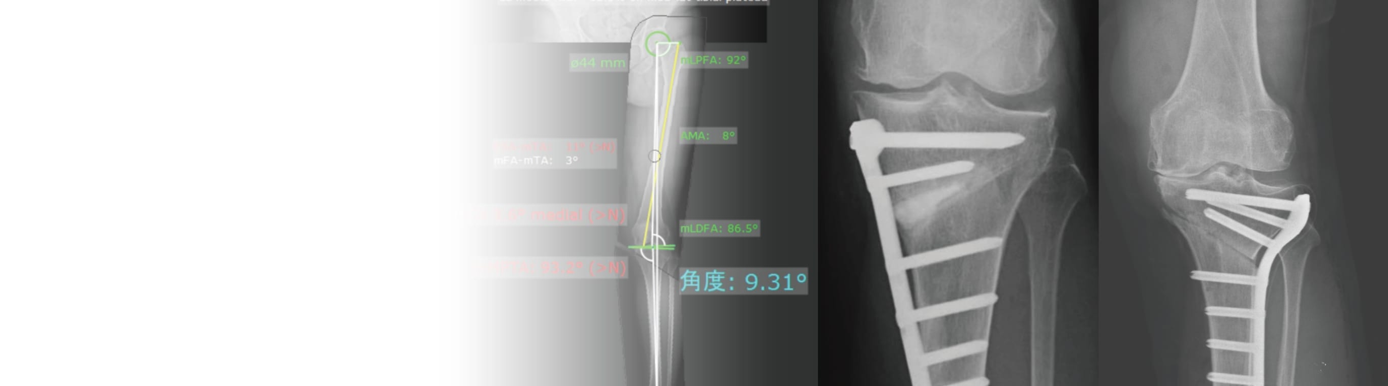 関節温存外科部門